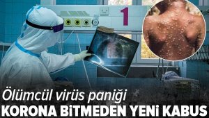 İki kişide "maymun çiçeği virüsü" görüldü