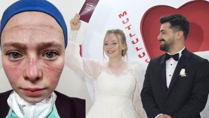 Sağlıkçıların simgesiydi! Hemşirenin mutlu günü