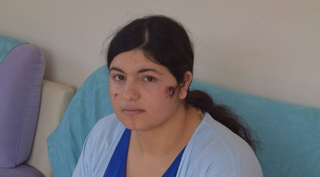 İzmir'de dövülen kadın dehşet anlarını anlattı