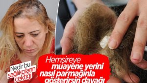 Kadın hasta, hemşirenin saçlarını yoldu