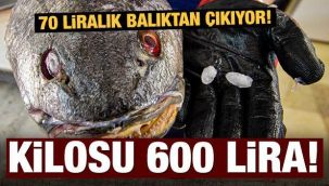 Kendisi 70, kafasındaki taşın kilosu 600 lira