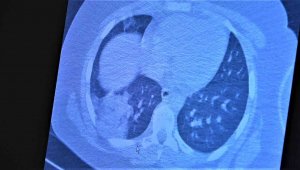 Aşısız gençler ciddi şekilde risk altında