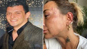 Eski sevgiliye dayağa tutuklama