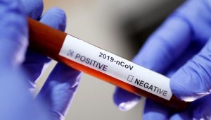 Korona virüsten 186 kişi hayatını kaybetti