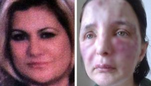 Sahte estetikçiye hapis cezası