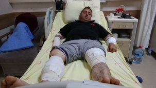 Ayıyla güreşti, ölümden kurtuldu