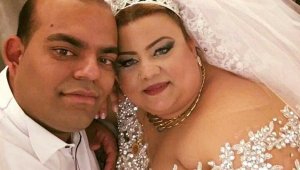 Mide küçültürken öldü, doktora komik ceza