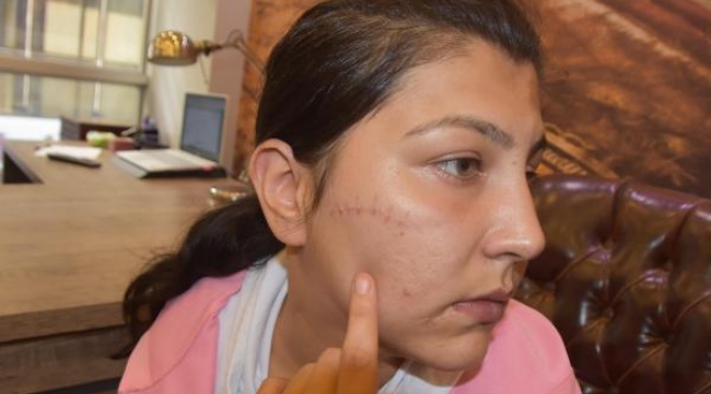 Bir kadın kendini 104 kez bıçaklayabilir mi?