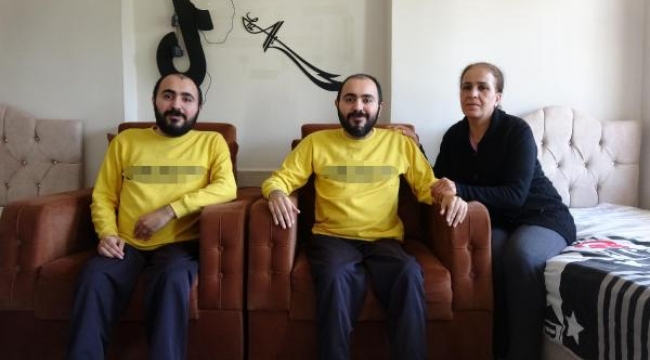 Engelli ikizleri türküler hayata bağlıyor