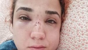 Kadın çalışanın burnunu kırdı 4,5 yıla kadar hapis isteniyor