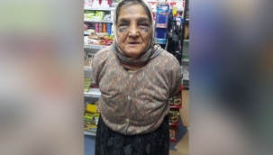 Kocası, 73 yaşındaki kadını bu hale getirdi