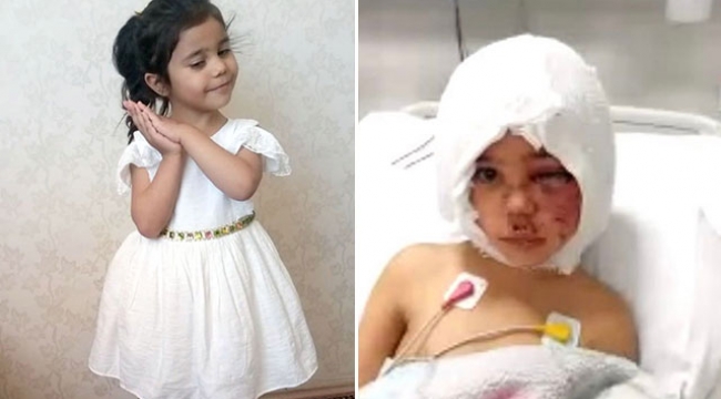 Pitbull saldırısında yaralanan Asiye'ye doku nakli