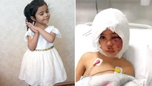 Pitbull saldırısında yaralanan Asiye'ye doku nakli