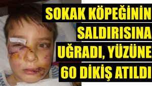 Sokak köpeği Mert'in yüzünü parçaladı