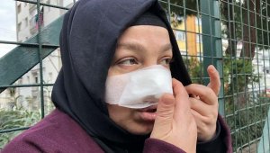 Spor yaparken pitbull saldırısında burnundan yaralandı