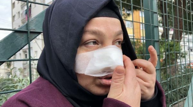 Spor yaparken pitbull saldırısında burnundan yaralandı