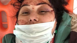 Trafiğe kapalı yolda yürürken kazada yaralandı