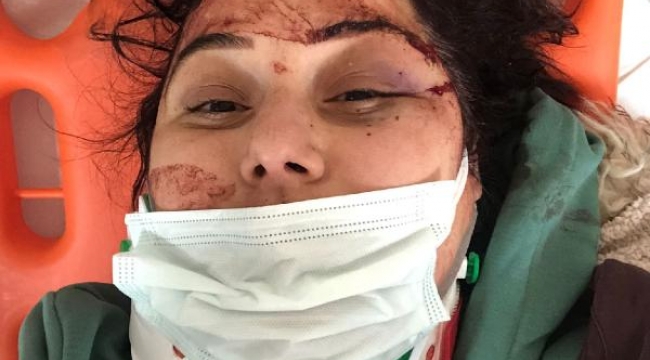 Trafiğe kapalı yolda yürürken kazada yaralandı