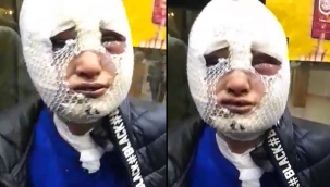 Vahşet! Eski sözlüsünün üstüne kızgın yağ döktü