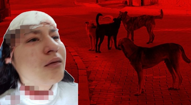 Sokak köpekleri saldırdı, yüzünü parçaladı