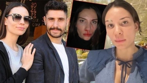 Futbolcu eşinden gördüğü şiddeti anlattı