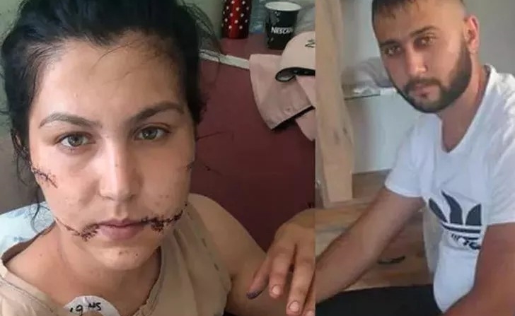 Kadın hakimler, Aysel'e şiddetin izlerini inceledi