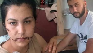 Kadın hakimler, Aysel'e şiddetin izlerini inceledi