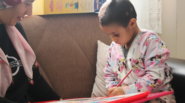 Pitbullun yaraladığı küçük Asiye'nin son hali