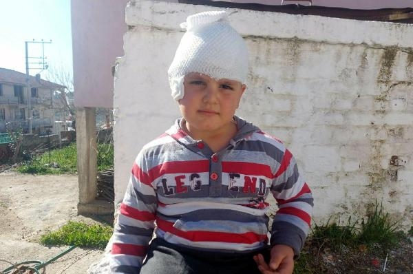 Sevmek istediği Pitbull melezi, hastanelik etti