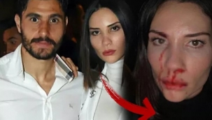 Ünlü futbolcuya, eşinden şiddet suçlaması