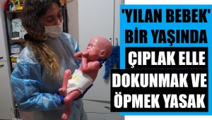 'Yılan bebek' Gökdeniz 1 yaşında