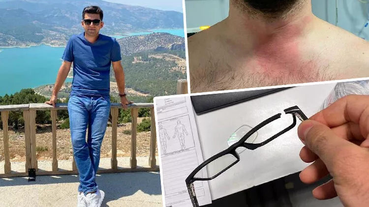 Doktor, Tıp Bayramı'nda darbedildiğini iddia etti