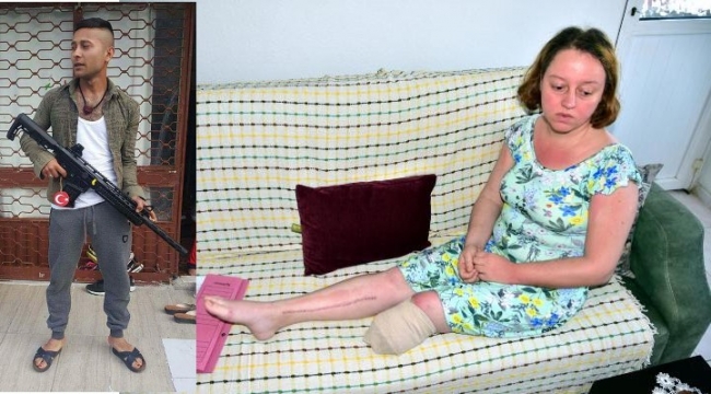 Eşini bu hale getirdi! Pişmanmış