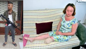 Eşini bu hale getirdi! Pişmanmış