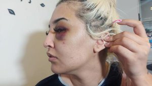 Eski sevgilisini feci şekilde dövüp, '2 saat uyuyalım, gideceğim' demiş