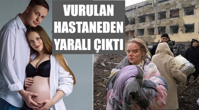 Ukraynalı kadın, vurulan hastaneden yaralı çıktı