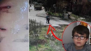 Köpeklerden ölü taklidi yaparak kurtuldu!