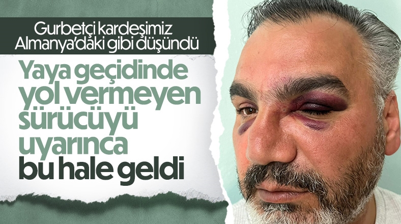 Yaya geçidinde yol vermeyen sürücü üstüne bir de dövdü