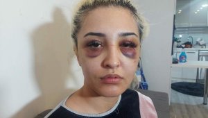 3 saat işkence gördüm ama şikayetçi değilim!