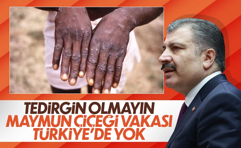 Bakan Koca'dan maymun çiçeği hastalığı açıklaması