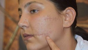 Şiddet Mağduru Aysel: 'Dışarı çıkarsa yarım kaldığı işi tamamlayacak'