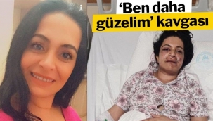 Kıskandığı eltisini ağzından vurdu