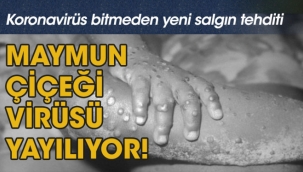 Maymun çiçeği virüsü yayılıyor! Korkutan uyarı