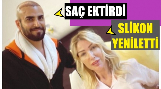 Seda Sayan silikonlarını yeniletti, eşi saç ektirdi