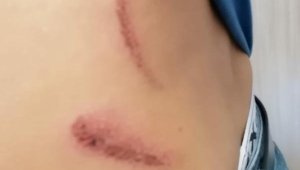 Manisa'daki 'yol verme' kavgasına 8 tutuklama