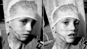 'Suriyeliler, çocuğa kezzap attı' iddiası yalan çıktı