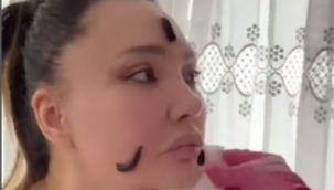 Ünlü şarkıcı yüzüne sülük koydurttu