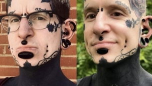 13 yıldır dövme yaptırdığı vücudu siyaha büründü