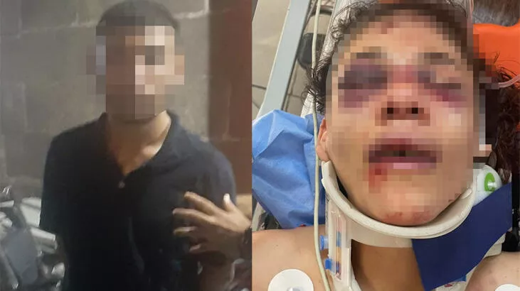 20 yaşındaki kadın, 51 kez bıçaklandı