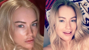 Ünlü şarkıcı Hilal Cebeci kanser oldu